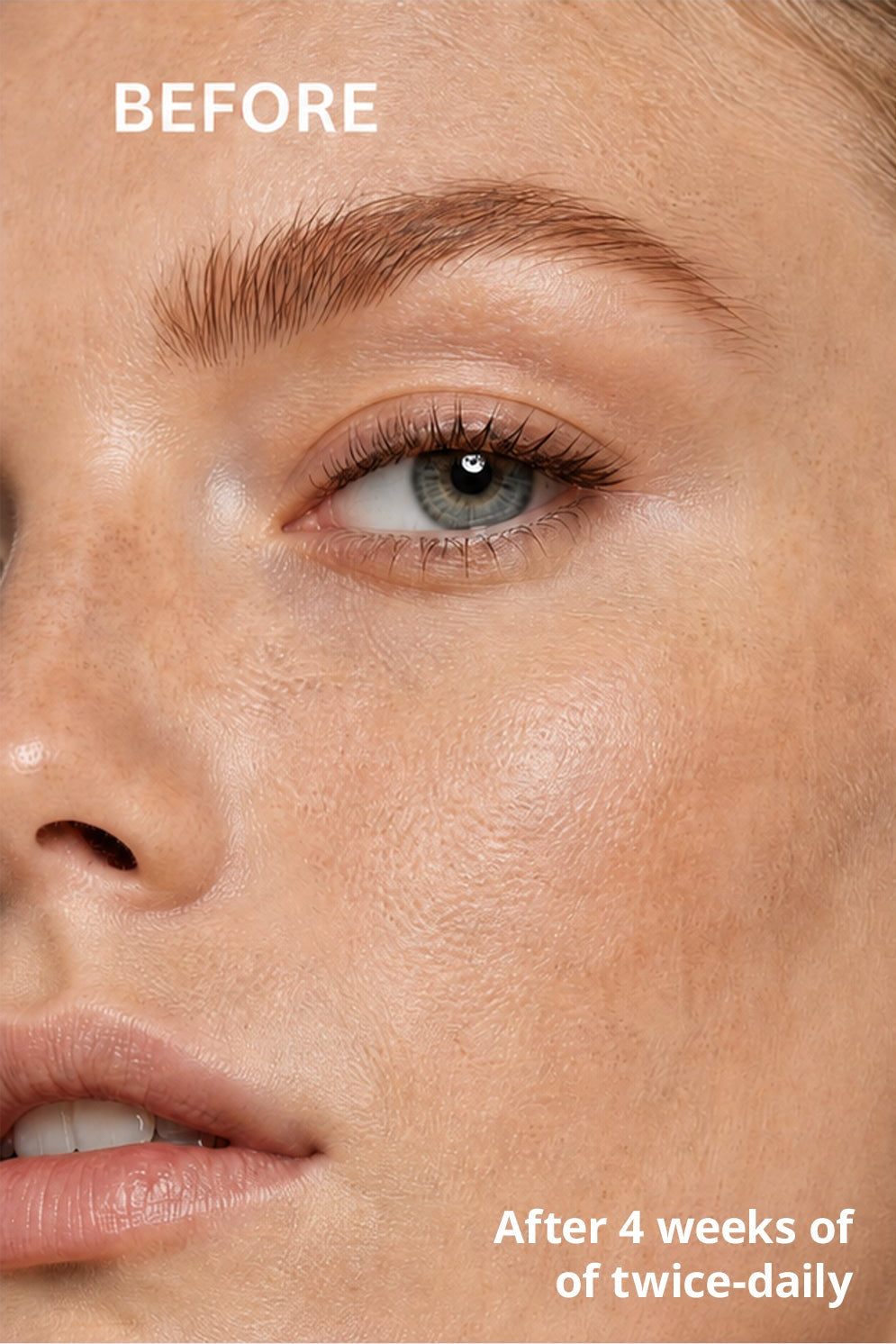 HYALURONICACID SERUM