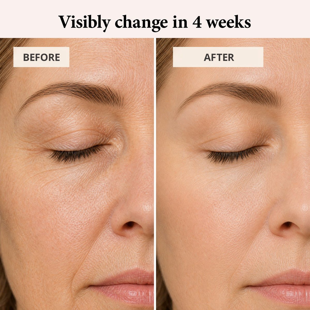 Retinol Serum